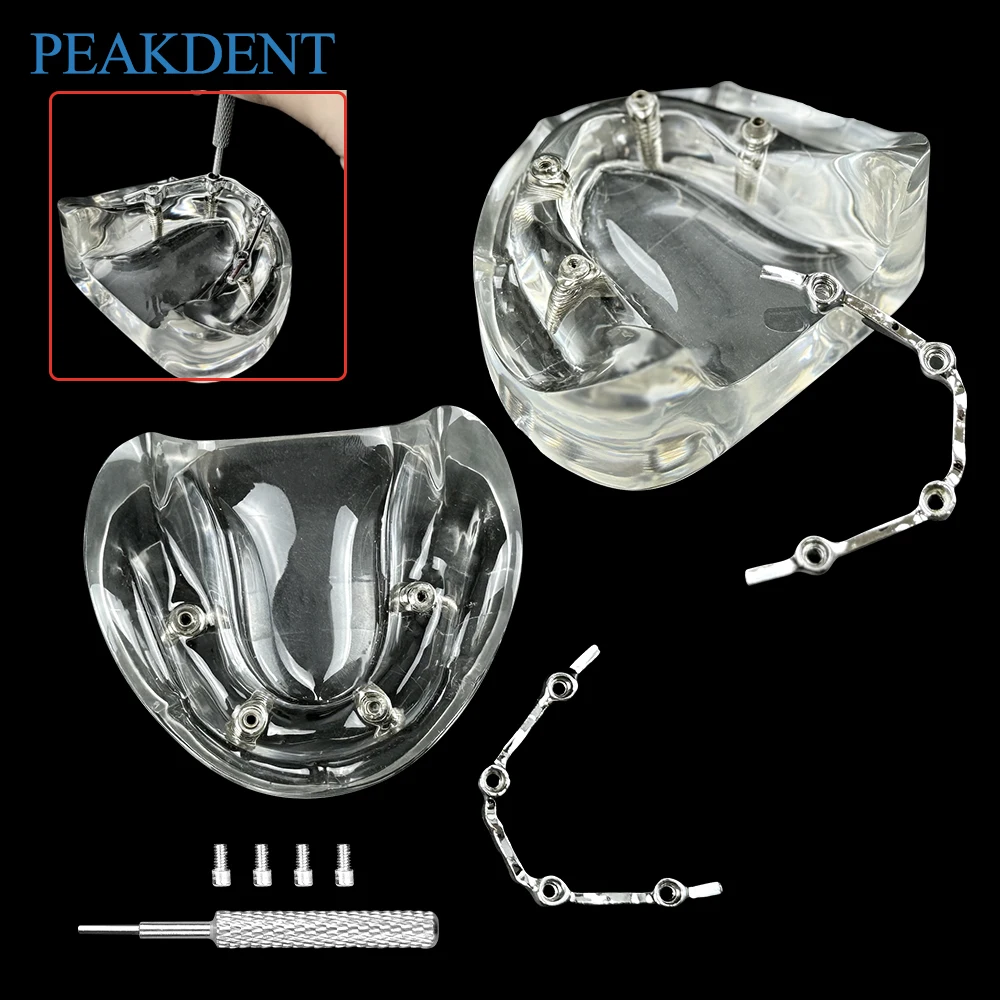

1pcs Dental Model Implant Restoration Model Maxillary Removable Model With 4 Implants for Dentisit Teaching Research