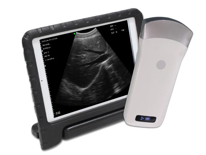 Vet Ultrasound Scanner Karestar Handheld WiFi 128 Element  Doppler Veterinary Wireless Ultrasound