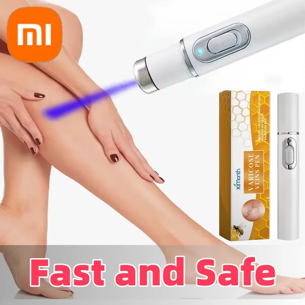 Xiaomi Therapy Leg Repair Pen Relieves Leg Bulge Discomfort Improving Blood Circulation Varicose Veins Pen Skin Care Product New