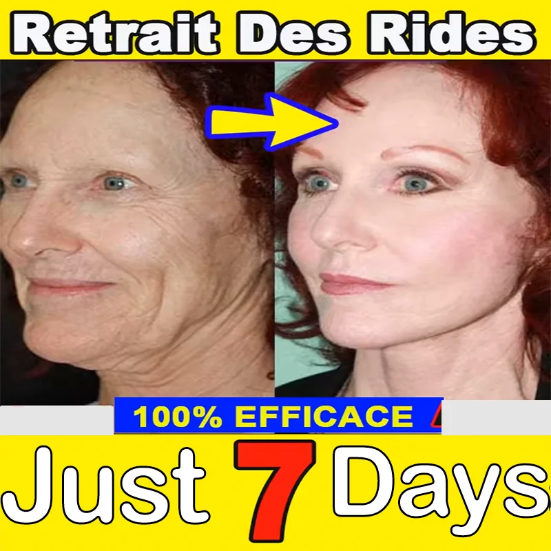

Eliminate Wrinkles Instant Anti - Wrinkle Serum for Facial Wrinkles Fine Lines Crow's Feet and Neck Wrinkles Beauty Health cream