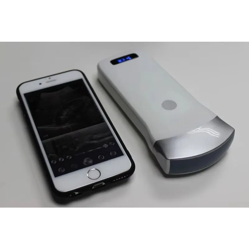 Medsinglong MSLPU40 Wireless Handheld Ultrasound Scanner – Portable Ultrasound Machine for Clinical Use