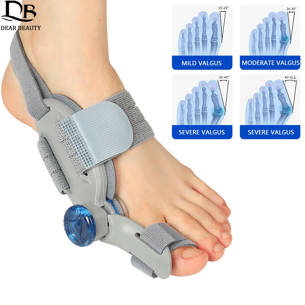 

Bunion Corrector For Woman Man Foot Thumb Hallux Valgus Correction Brace Adjustable Rotatable Big Toe Straightener Separator