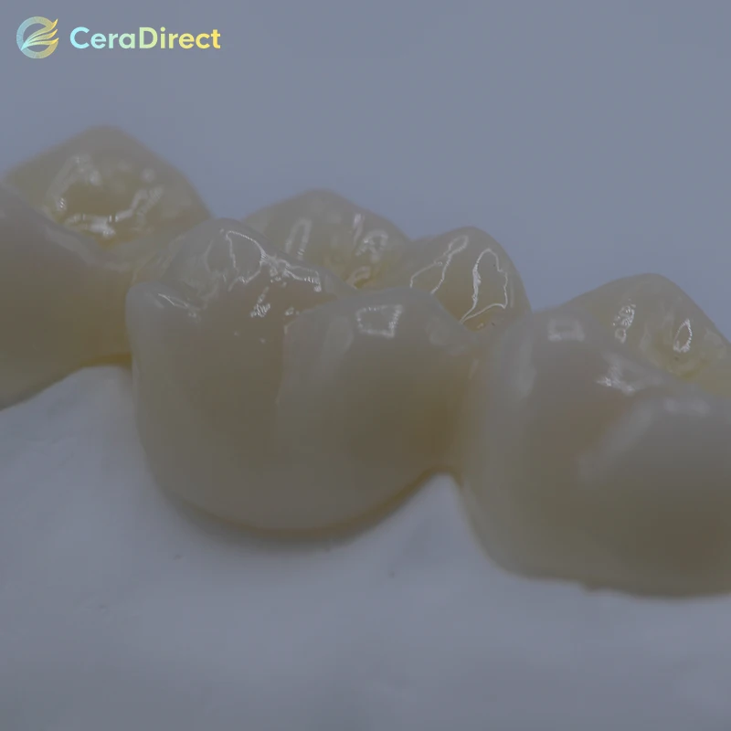 Ceradirect SHT White Zirconia（95mm)tooth replacement material—CADCAM for Dental Lab 95 system