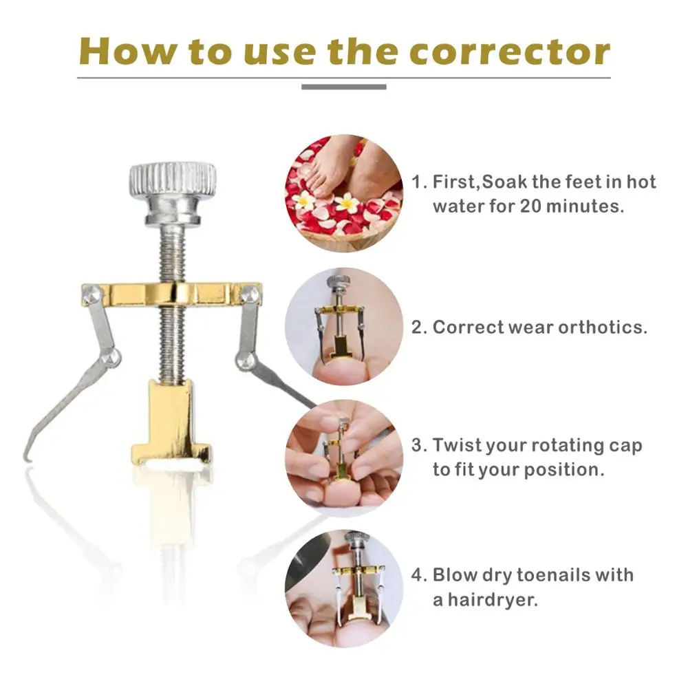 1Pcs Ingegroeide Teennagels Fixer Orthesen Toe Nail Herstellen Orthesen Correctie Tool Voetverzorging Apparaat Manicure Pedicure Set Machine