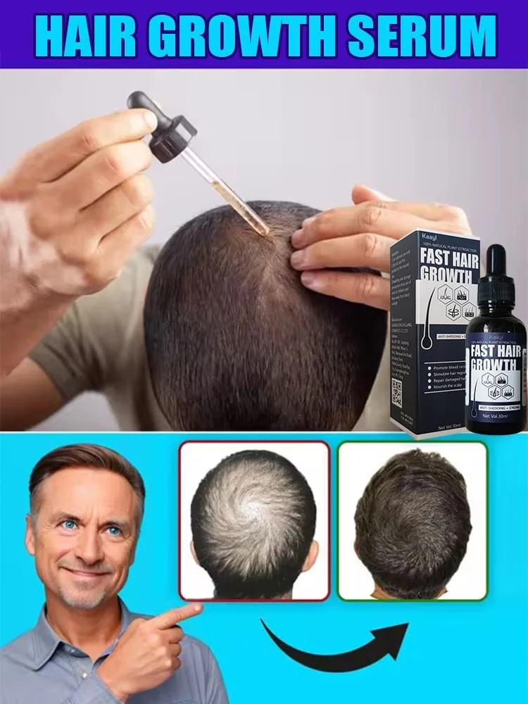 

98% of buyers buy again, have more and more hair, say goodbye to baldness, thick hair,Hot selling product.