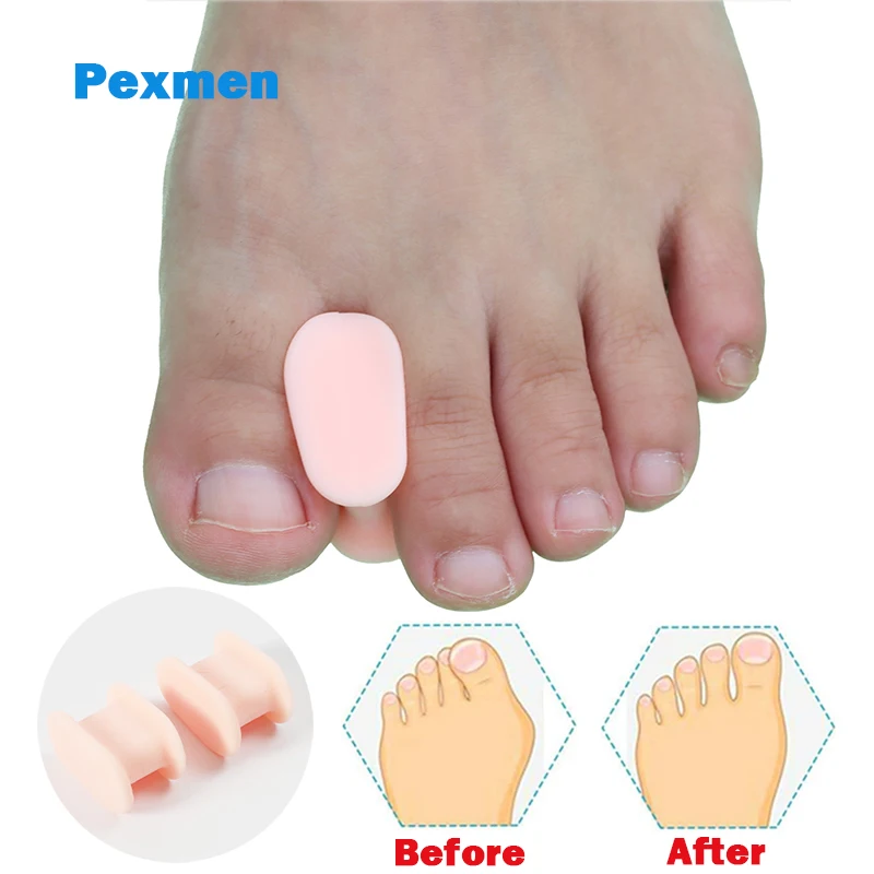 2/4 шт., разделители для пальцев ног, для мужчин и женщин