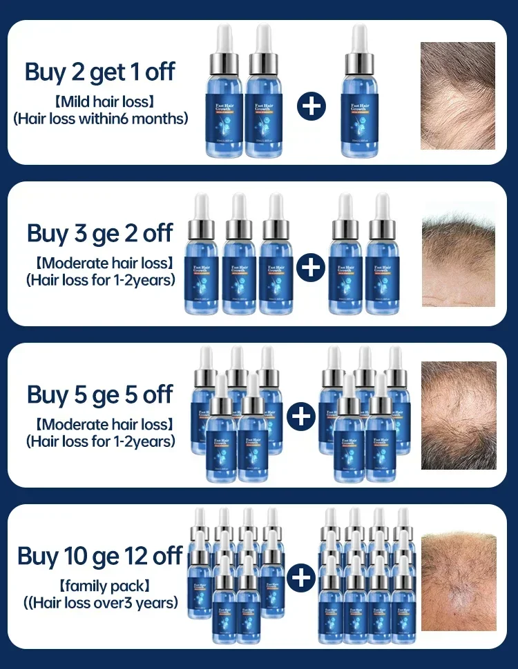 Fast Hair Growth Hair Growth Oil Effective Baldness Repair Hereditary Hair Loss Postpartum