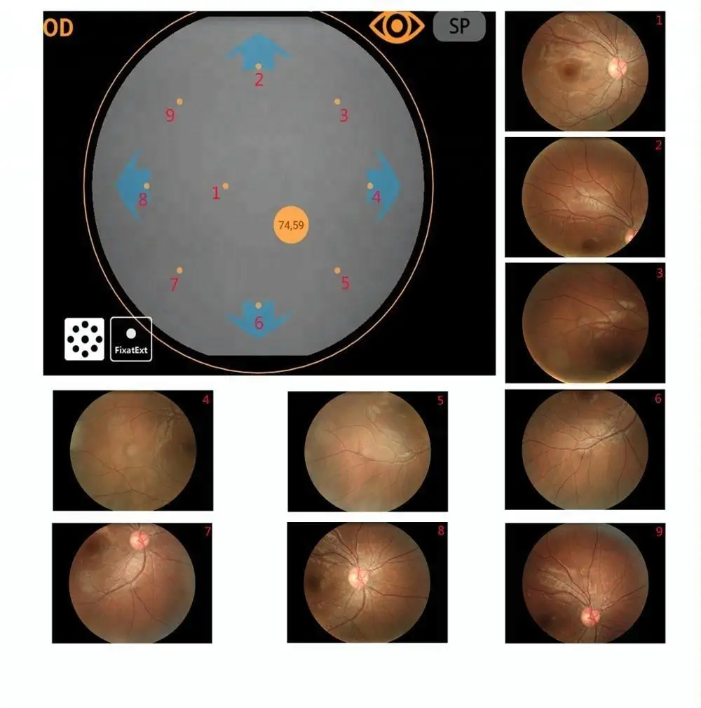 MY-V036B Auto detected the eye position fundus camera digital fundus photography retina camera Price for ophthalmology