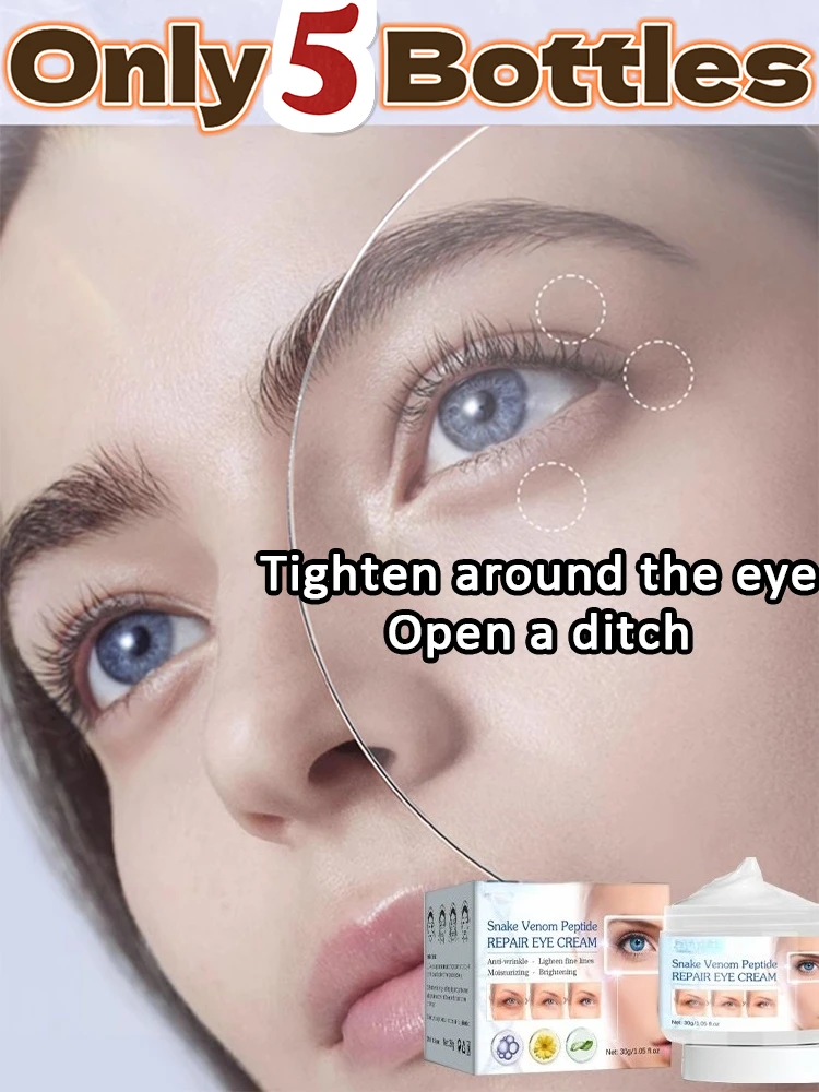 Eye Cream Tightens The Skin, Removes Wrinkles, Delays Aging and Removes Wrinkles. Trouble Dark Circles and Bags Under The Eyes
