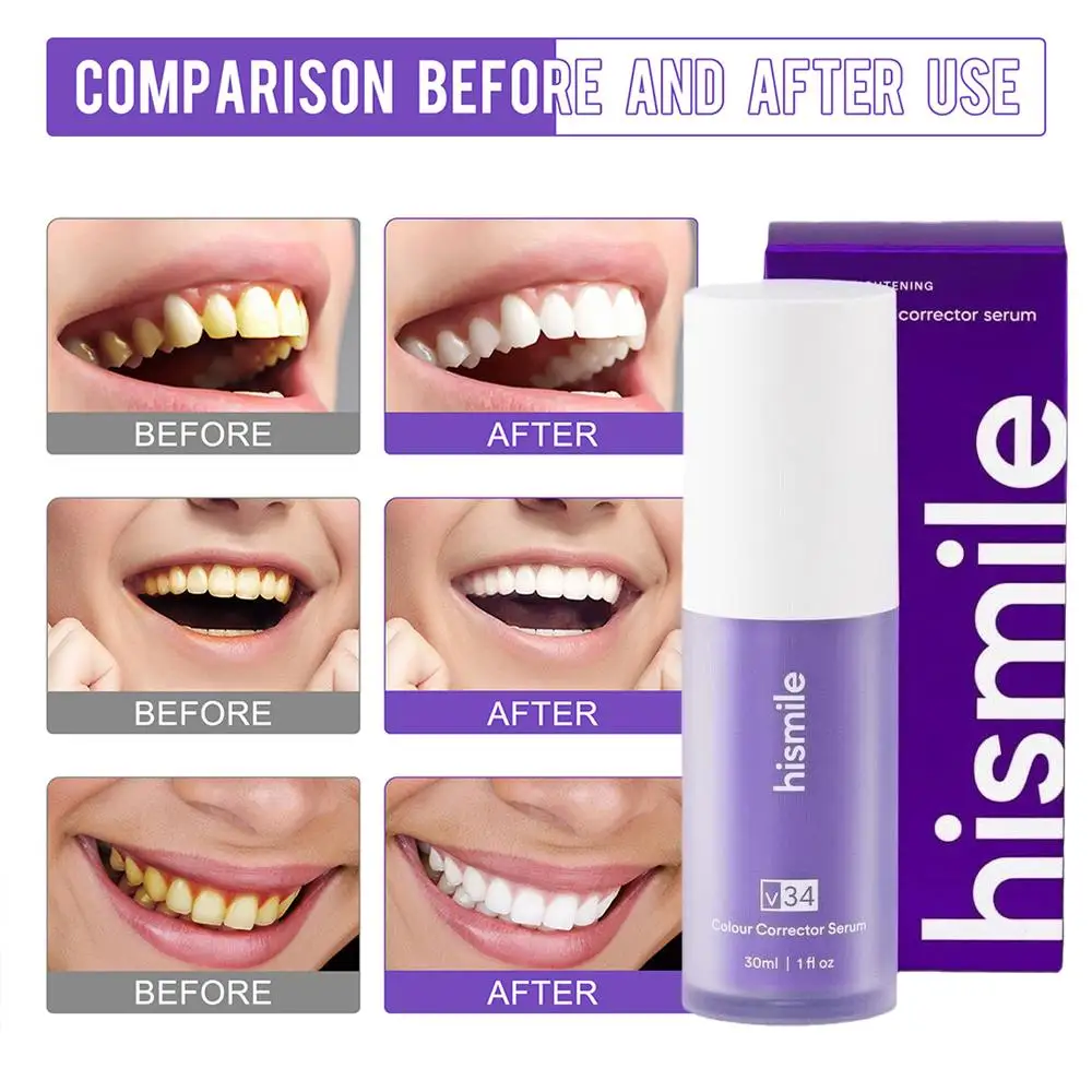 Purple Teeth Whitening Toothpaste White Teeth Toothpaste For Pain Sensitive Teeth, Teeth Whitening Toothpaste For Adults 30ml