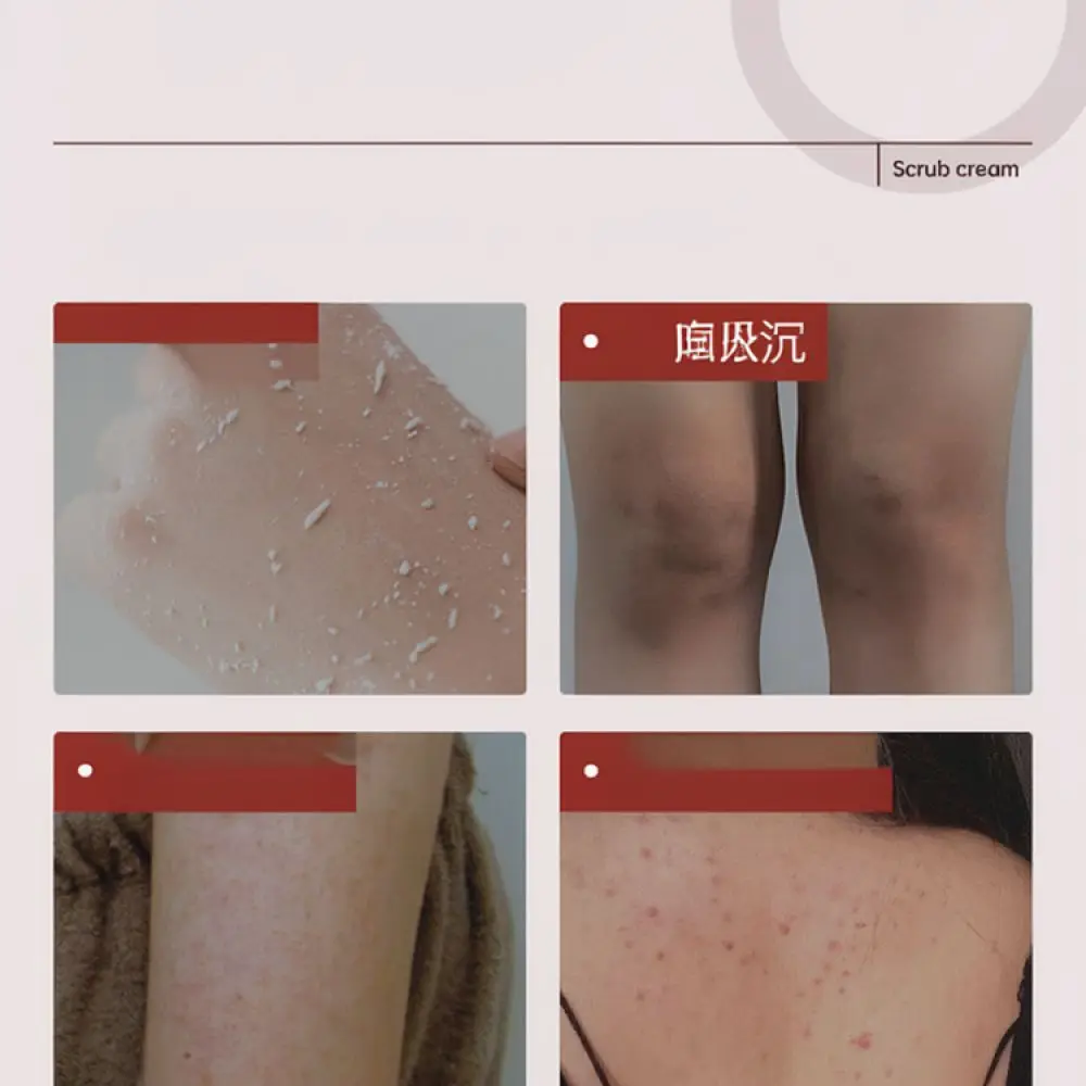 Exfoliator Body Scrub Cream For Pandasbeauty Fruit Acid Deep Cleaning Smooth Skin Texture Dead Skin Treatment Care