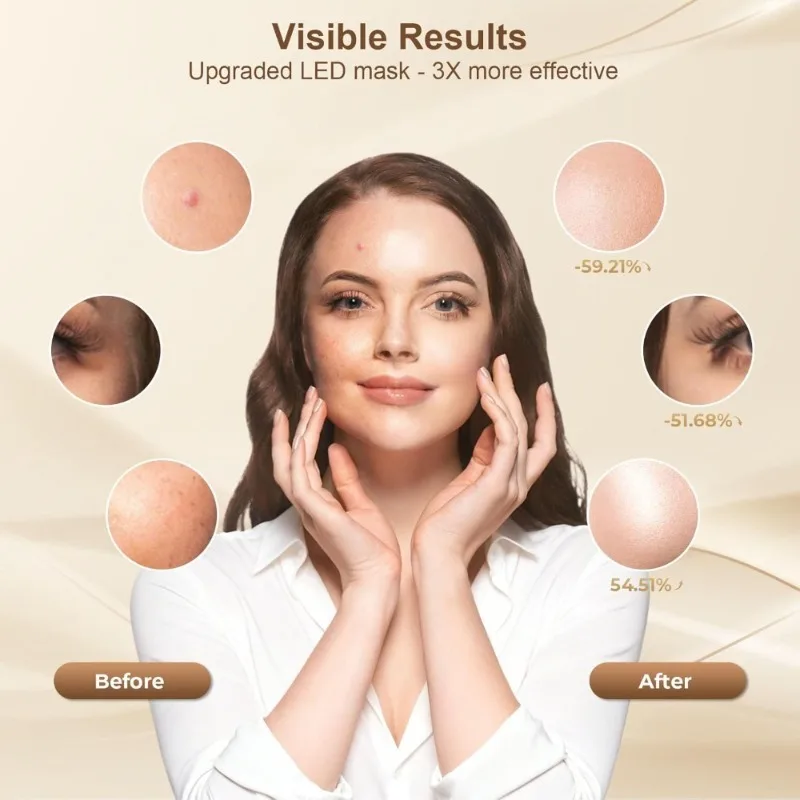 قناع علاج بالضوء الأحمر قناع وجه LED مع جهاز علاج بالضوء قابل لإعادة الشحن عن بعد للاستخدام المنزلي #3