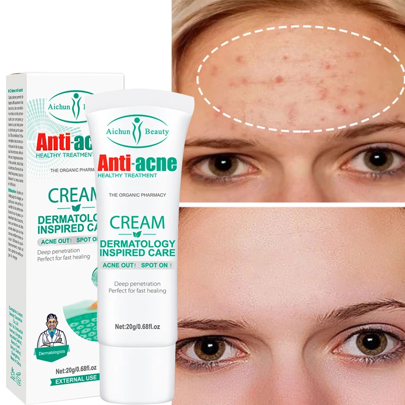 

1pcs Herbal Acne Removal Cream Whitening Moisturizing Shrink Pores Oil Control Pimples Acne Treatment Cream Skin Care 20g