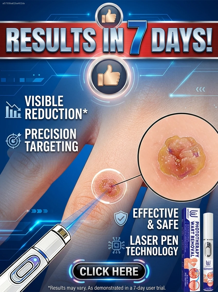 

Laser pen wart removal without ʷᵒʳʳʸⁱⁿᵍ ᵃᵇᵒᵘᵗ ⁱⁿᶠᵉᶜᵗⁱᵒⁿ ᵒʳ ⁱⁿᶠˡᵃᵐᵐᵃᵗⁱᵒⁿ