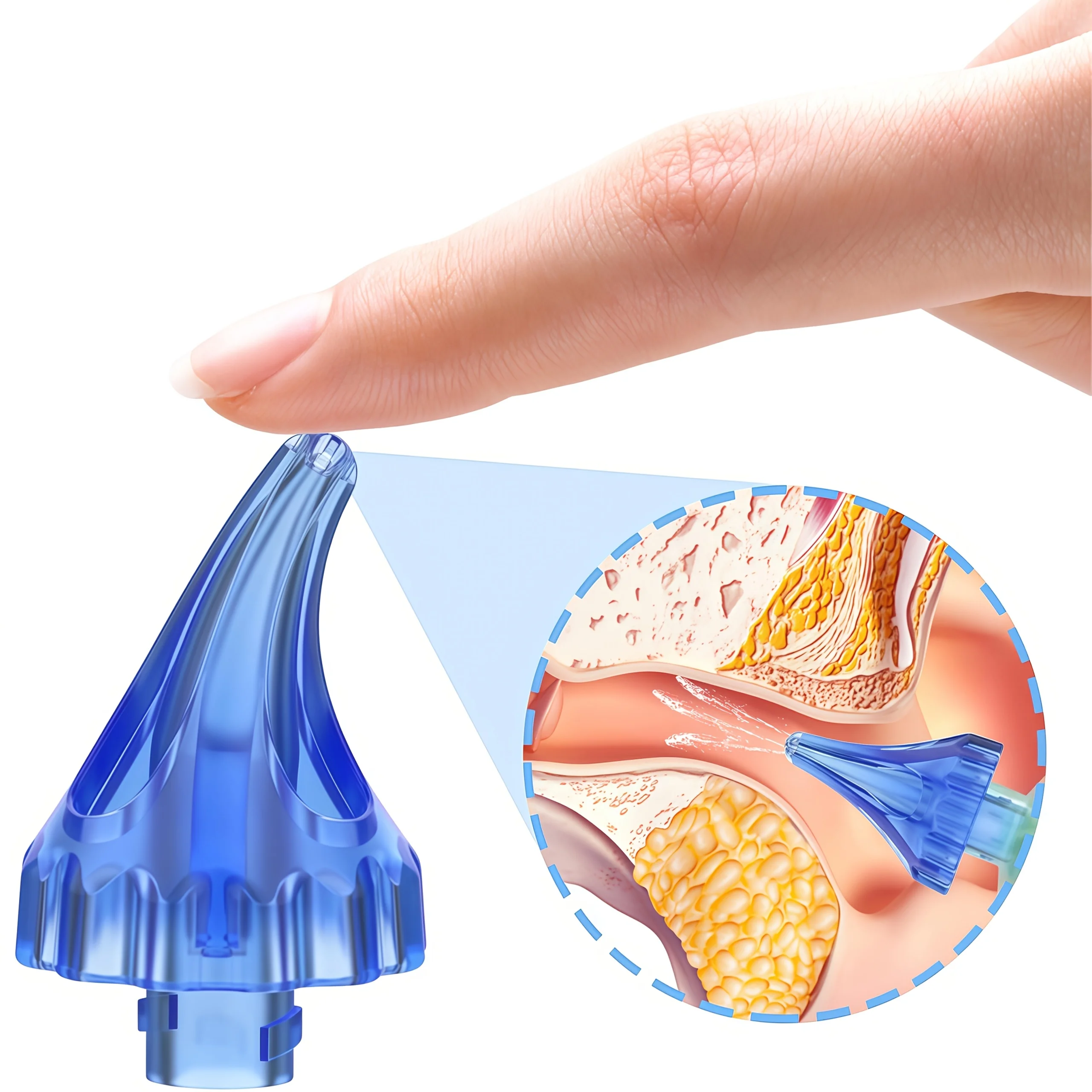 Thumbnail 4 - #32 Best Selling Ear Syringes