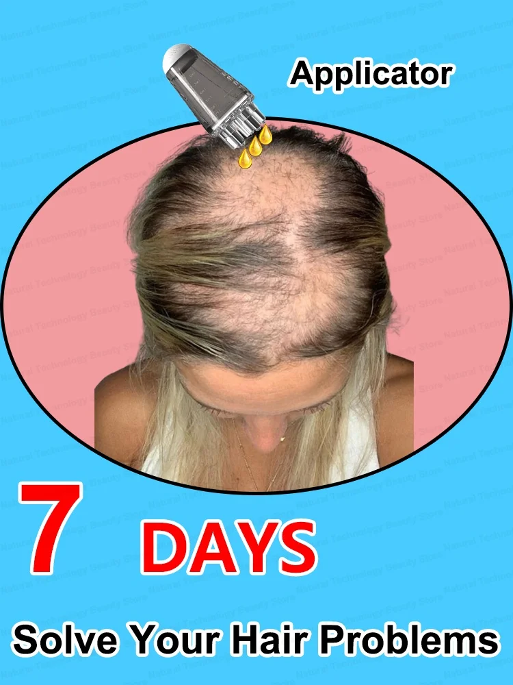 

Solve your hair problems
