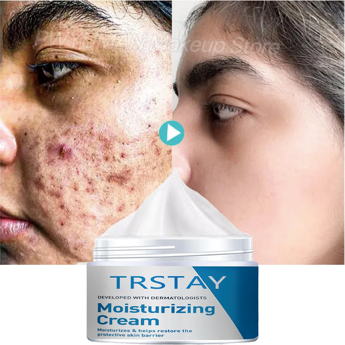 

TRSTAY Увлажняющий крем для ухода за кожей - Крем для лица помогает восстановить защитный барьер во время беременности и материнства