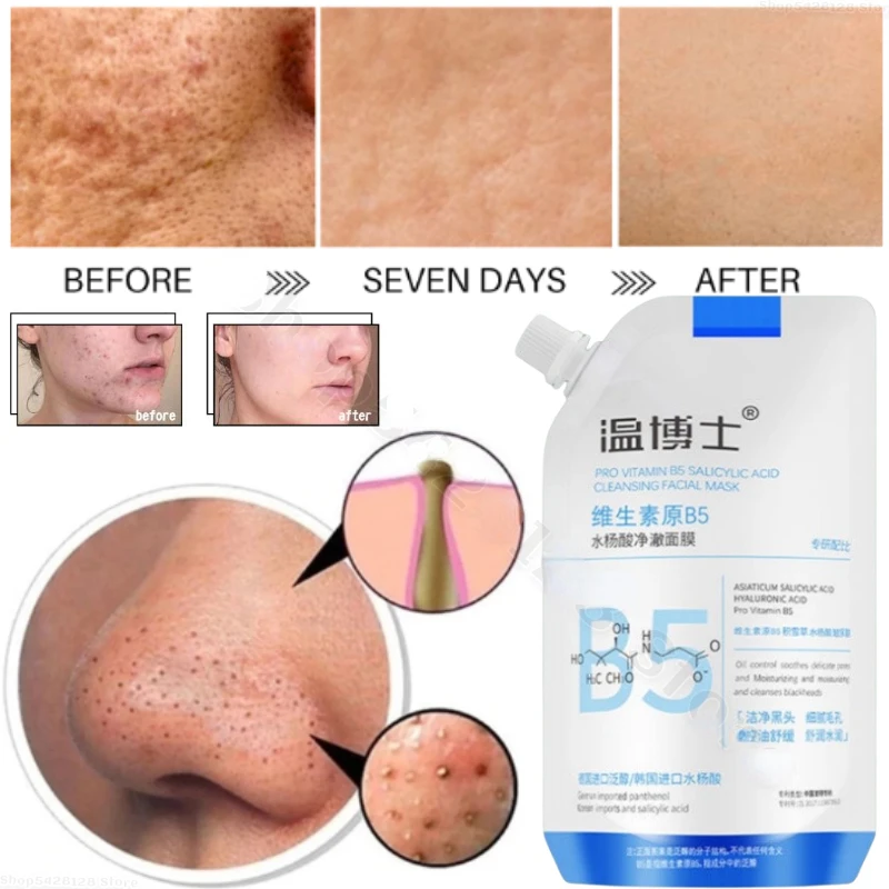 200ml Dr. Wen Provitamin B5 Salicylic Acid Cleansing and Moisturizing Blackhead Repair Acne Muscle Mask