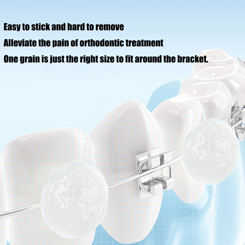 GULPOOE 60pcs Dental Dental Orthodontic Portable Protective Wax Braces Anti Grinding Mouth Dental Wax Independent Installation