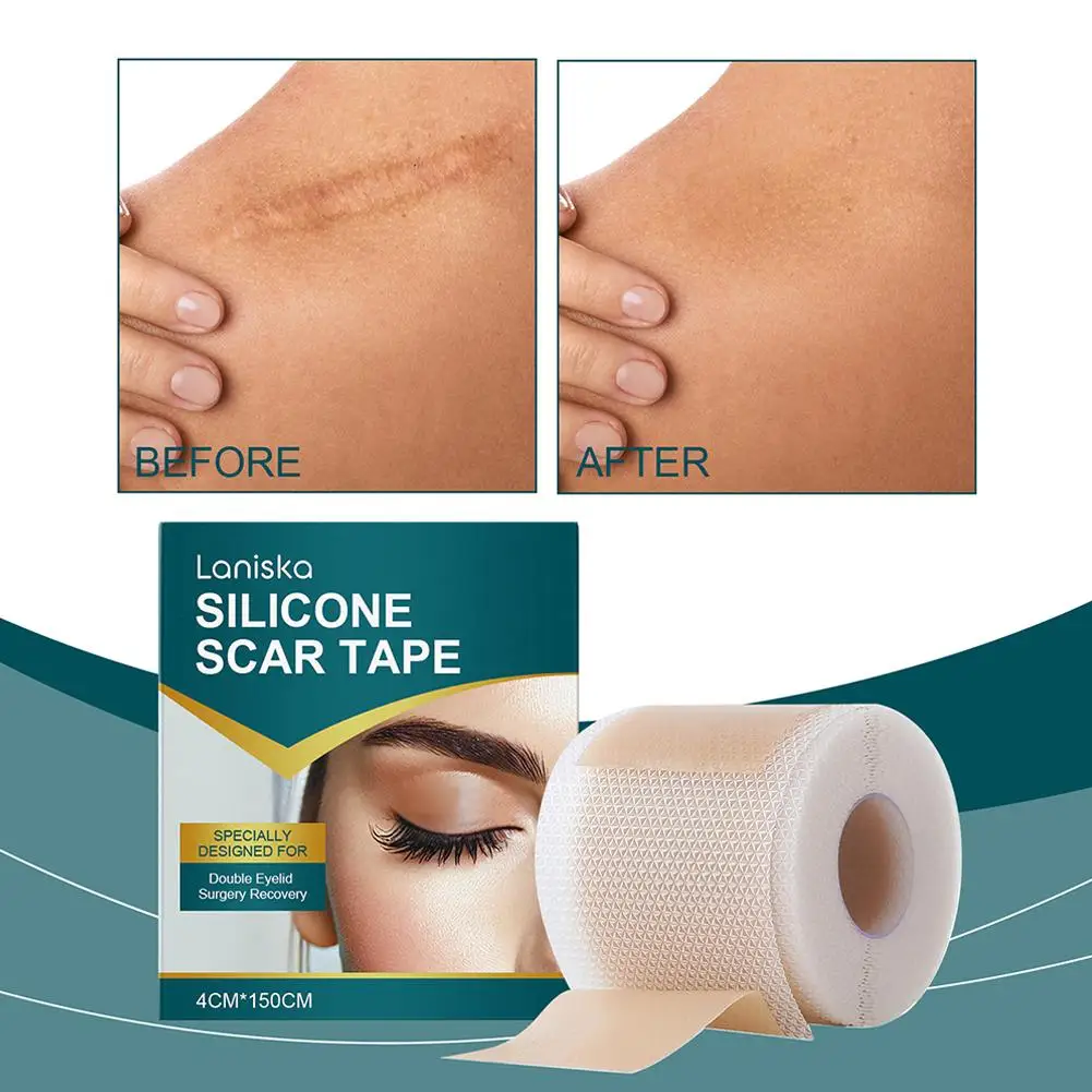 Remendo de cicatriz de gel de silicone dupla pálpebra cicatriz capa remendo pele acne remendo à prova dwaterproof água tom c-seção invisível cicatriz z5y3