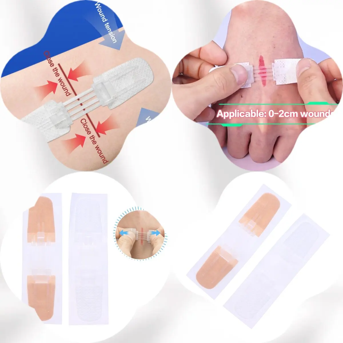 

Painless Wound Closure Zipper Band-Aid Suture-Free Dressing Patches Zip Suture Reducer For Convenient Wound Management