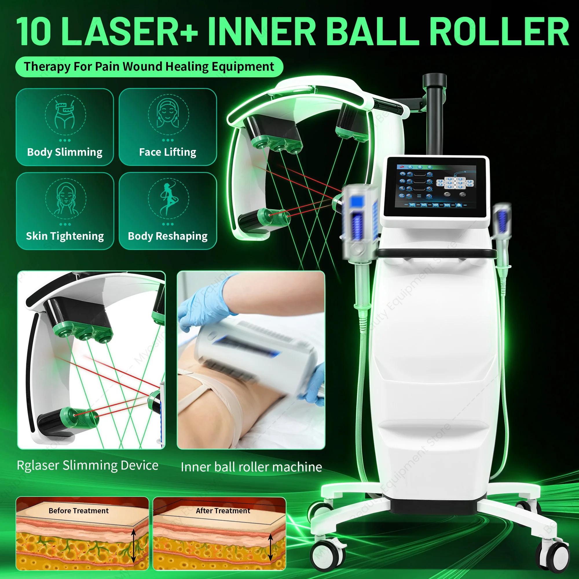 10D Maxlipo Master 532nm Green Light 635nm Red Removal Lipo Laser Fat Burning Cellulite 10d slimming machine  Newest