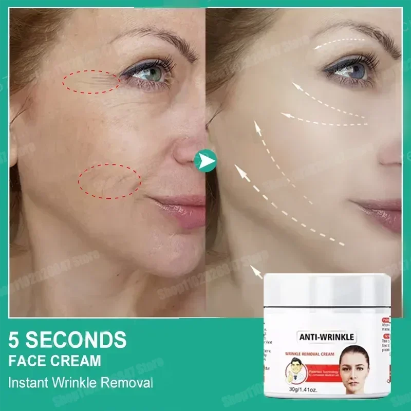 

Instant Anti Wrinkle Aging Effect Remove Facial Wrinkles Fade Fine Lines Firming Tightening Face Skin Care Korea Cosmetic