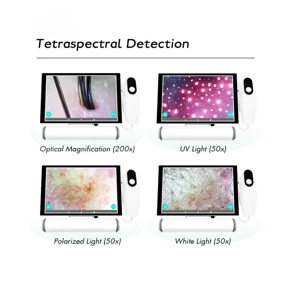 Professionelle Haut Tester Analysator Verwelkt Haarausfall Kopfhaut Haarfollikel Detektor Analysator/Kopfhaut Pigmentierung Maschine