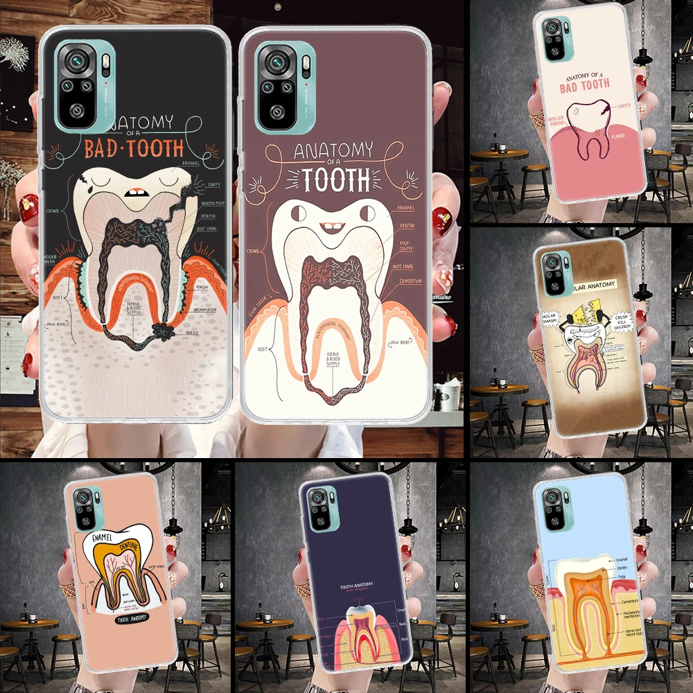 NEW ARRIVAL Dental Anatomy Bad Tooth Soft Phone Case For Xiaomi Redmi 9A 9C 9T 10A 10C 10 9 Prime 10X 8A 8 7A 7 6A 6 Pro K40 K20