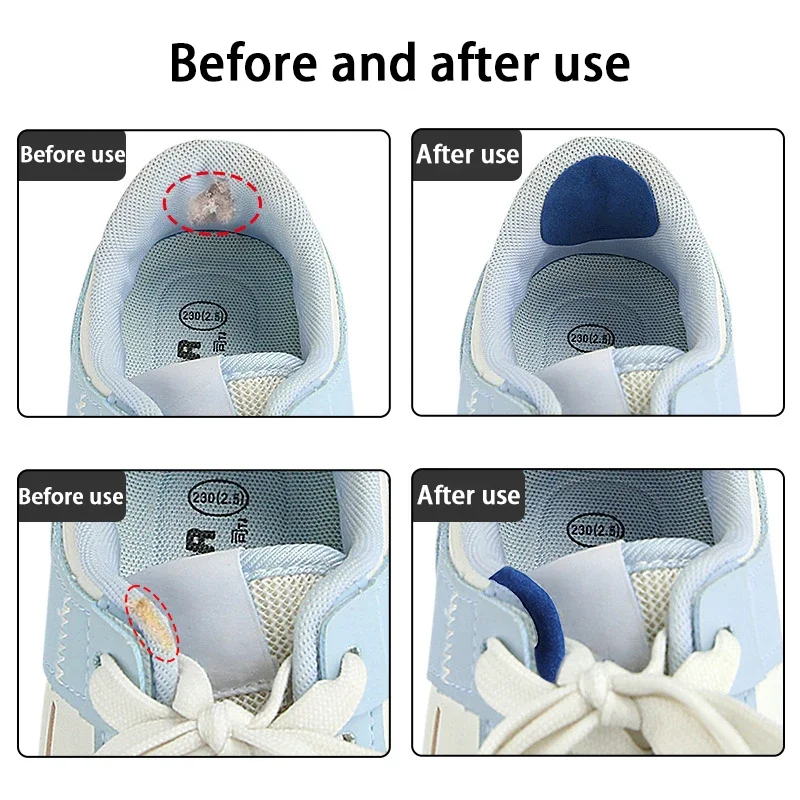 6 قطعة ملصقات كعب إصلاح العلوي أحذية رياضية كعب مكافحة كشط بقع الحذاء الجانب المسيل للدموع إصلاح بطانة ثقب إصلاح العناية بالقدم