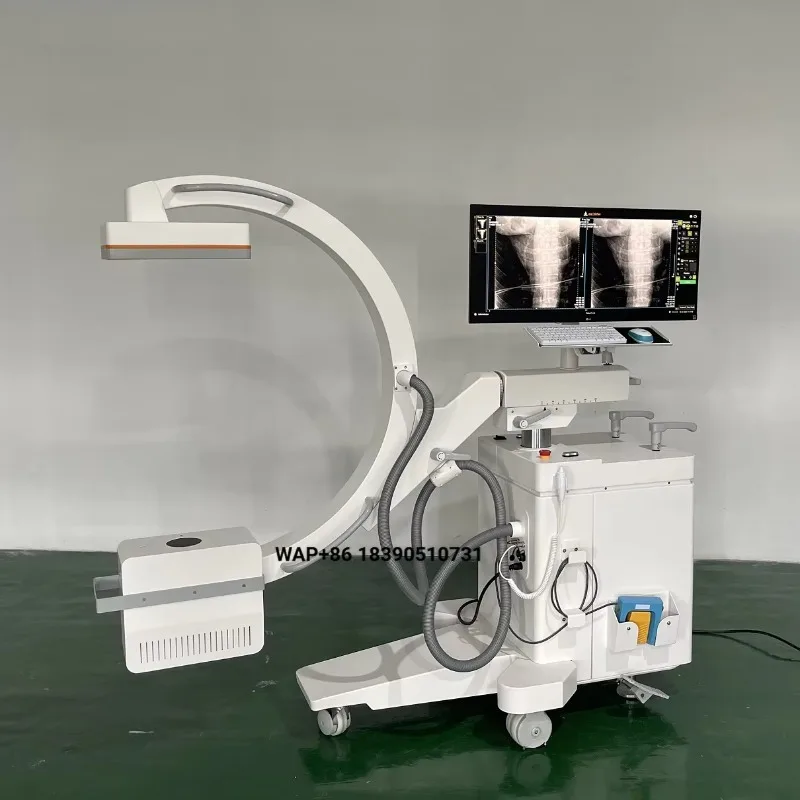 Hospital medical high frequency mobile c-arm system operating table surgical x-ray c-arm system