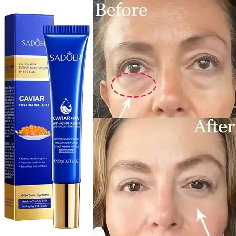 

Caviar Eye Bag Removal Cream Hyaluronic Acid Anti-Wrinkle Firming Skin Fade Fine Lines Anti Dark Circle Puffiness Eye Care 20g
