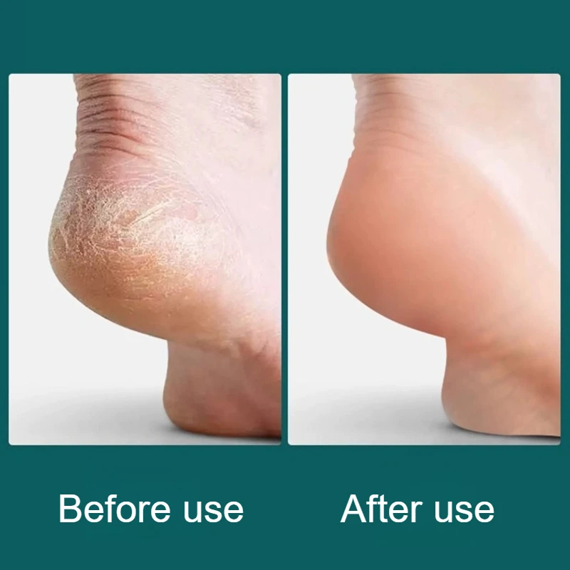1/2PCS Doppelseitige Ferse Peeling Haushalt Große Fuß Peeling Pinsel Haushalt Badezimmer Fuß Pflege Weiche haut Werkzeug