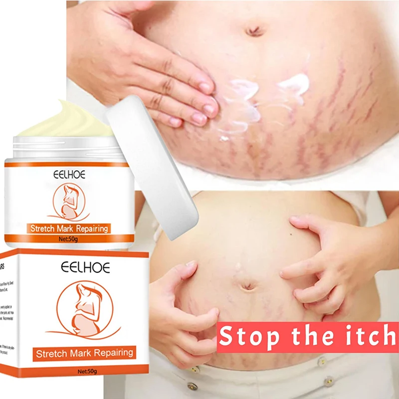 Stretch Marks Removal Cream To Remove Postpartum Obesity Pregnant Women Repair Anti-Aging Anti-Winkles Firming Body Cream Oil