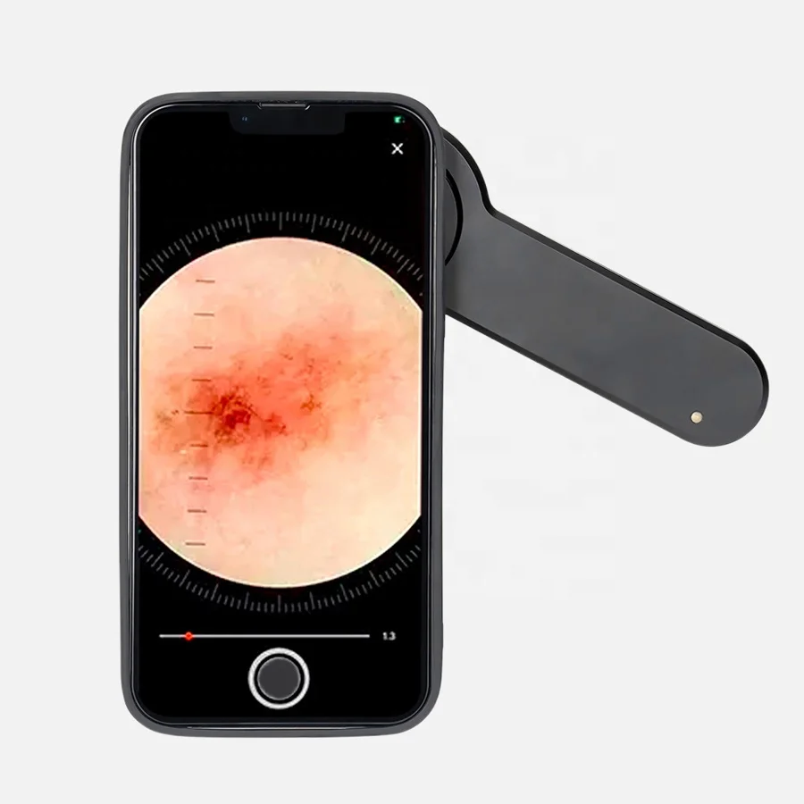 IBOOLO DE-3100 Electric Dermascope 10X Magnify Medical Device Aluminum Dermoscope with Amber Light