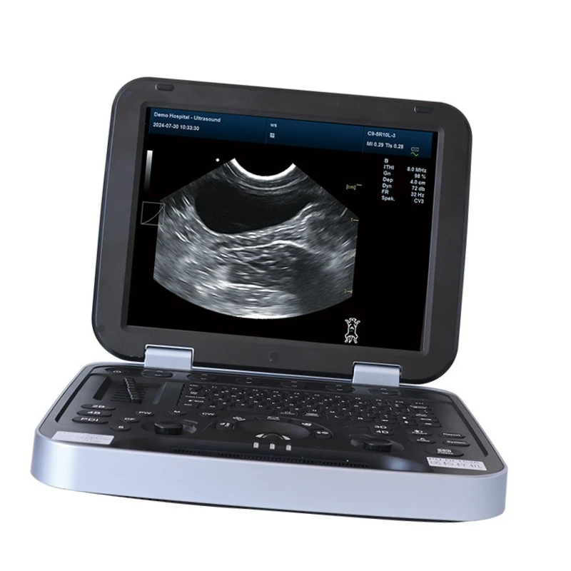 Veterinary Portable Ultrasound Machine | High-Resolution Pet Diagnostic Imaging System | Dual Probe Animal B-Scan