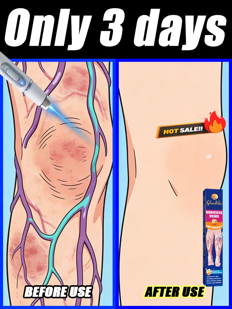 Vᴇɪɴ ʜᴇᴀʟᴛʜ ʟᴀsᴇʀ ᴘᴇɴ: Reduces bulges and provides comfortable care.