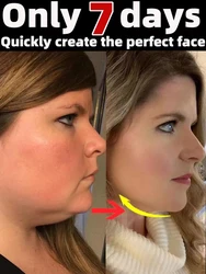 double chin reducer cream