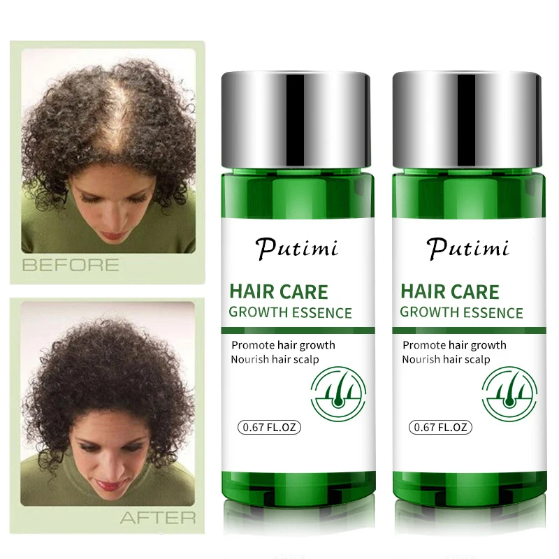 Soro do crescimento do cabelo para homens e mulheres, 30ml, produto natural do cuidado do cabelo para impedir a perda e o cabelo danificado, tslm1