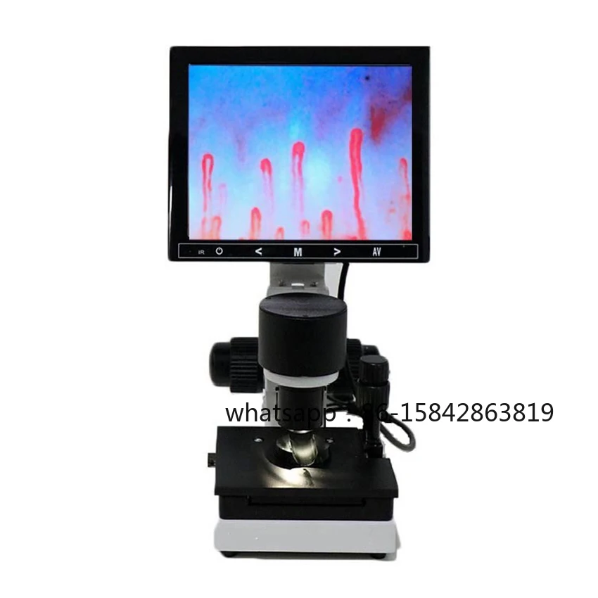 Digital Microscope Zoom Nailfold Capillary Microcirculation Detector Blood Microcirculation Analyzer with 7/8/9