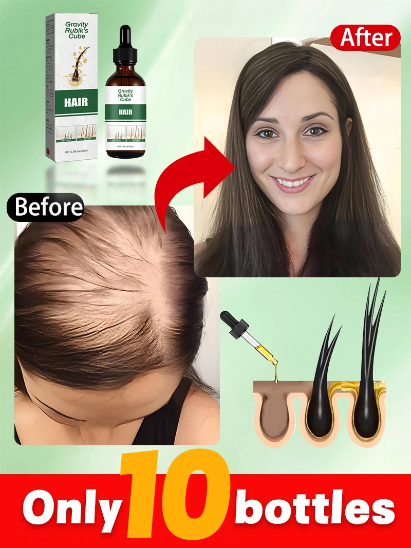 

Natural Plant Extracts Hair Care Essential Oil