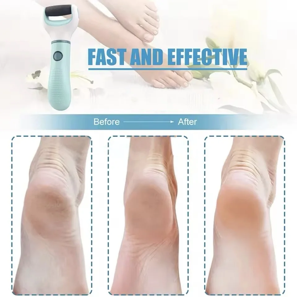 Kit elétrico removedor de calos de pé, arquivo purificador de pé à prova d'água recarregável, kit de ferramentas de pedicure profissional, cuidados com os pés para mortos