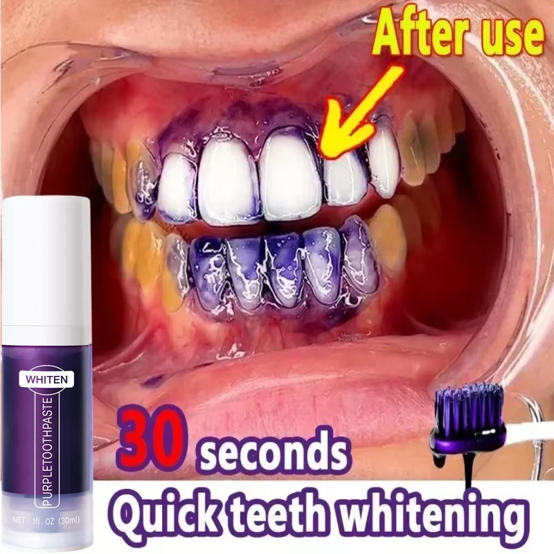 V34 Teeth Whitening Toothpaste Remove Plaque Coffee Stains Cleaning Oral Hygiene Bleaching Dental Tools Fresh Breath Tooth Care