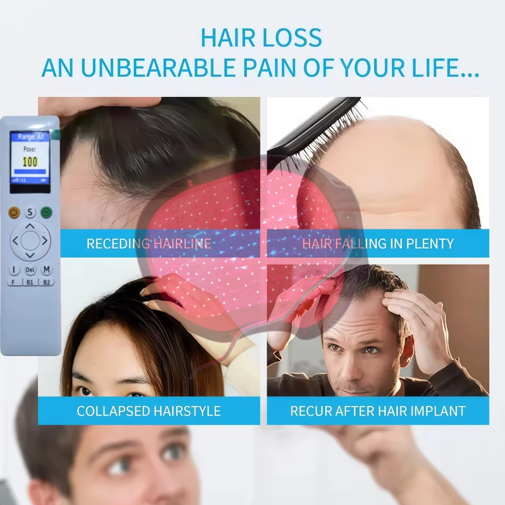 

Лазерный шлем для роста волос 6750 мВт, портативный аппарат для лазерной терапии LLLT с 90 лазерами и 210 светодиодами, для лечения выпадения волос