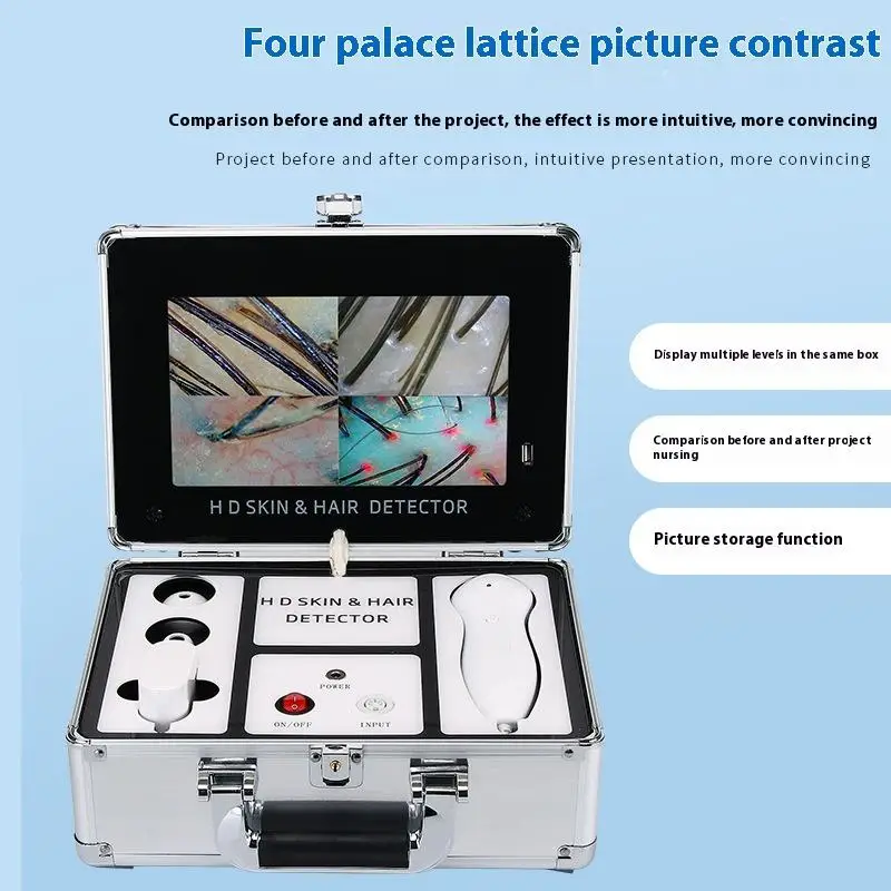 11 Inch Box Type Scalp Tester, Skin Tester, Portable Hair Follicle Detection All-in-one Machine, Commercial Plug-in Charging