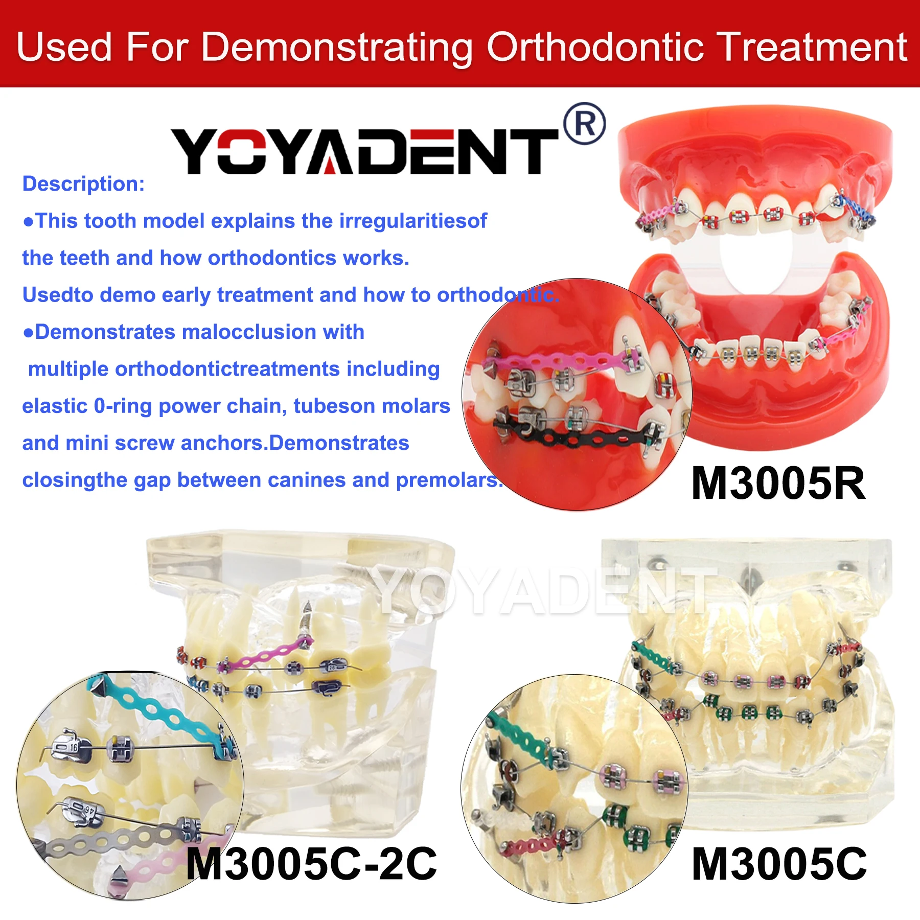

Dental Implant Model Metal Arch Wires Ties/ Ceramic Brackets Orthodontic Teeth Model For Patient Education Demo M3005C/R
