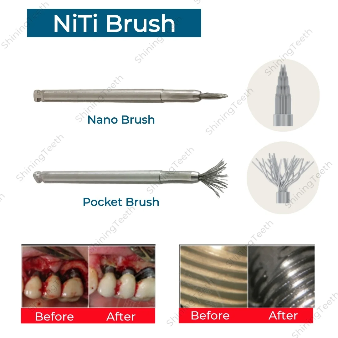 Dental Implant Surface Cleaning Titanium Brush Debridement Peri-Implantitis Threads Tool Maintenance Leaning