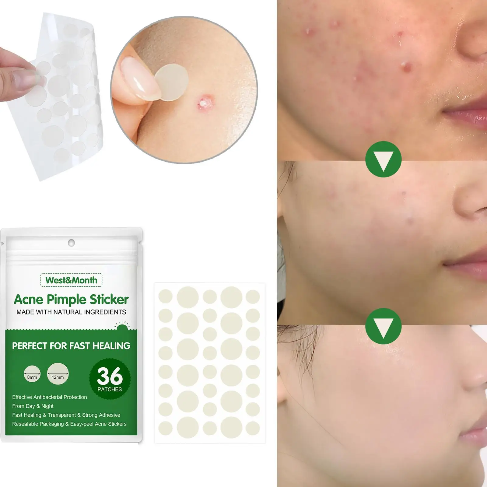 Parche adhesivo para acné, removedor de espinillas, tratamiento de acné, cuidado Facial, herramienta de mascarilla para manchas, 24/36 piezas