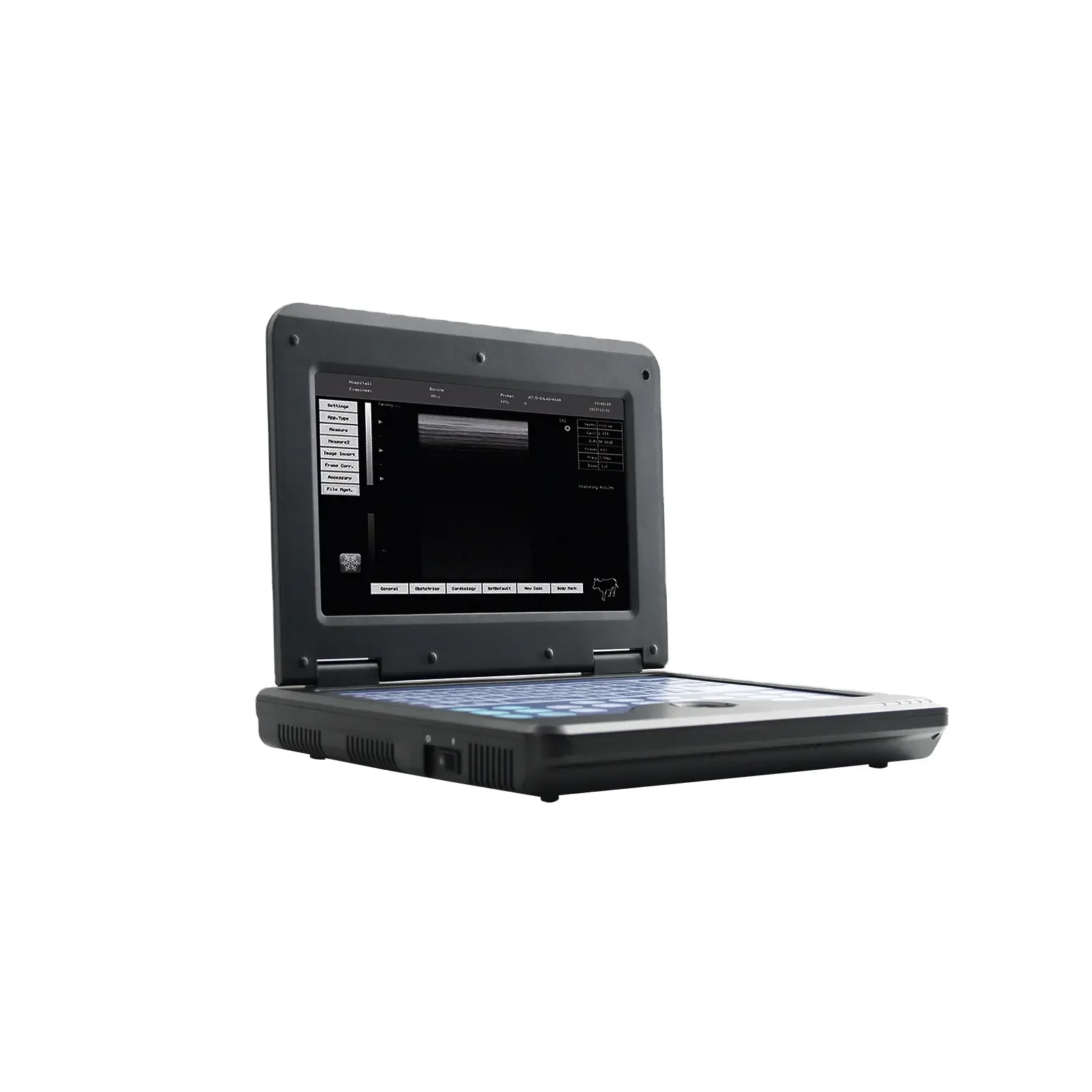 Color Tablet Ultrasound Portable Usg Machine Full Digital Portable B/W Ultrasound Scanner For Human