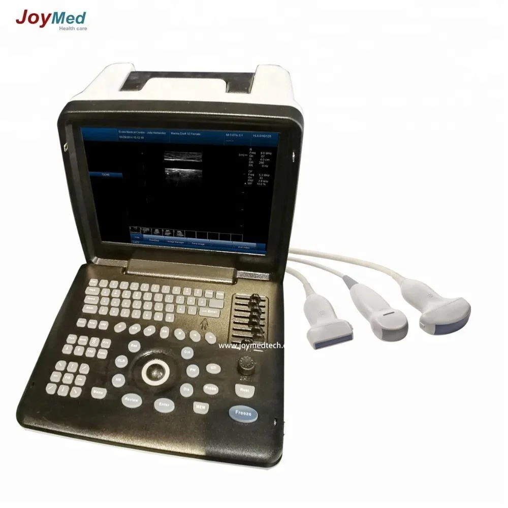 

China Medical Ultrasonic Equipment portable ultrasound machine trade assurance ultrasound scanner with cheap price